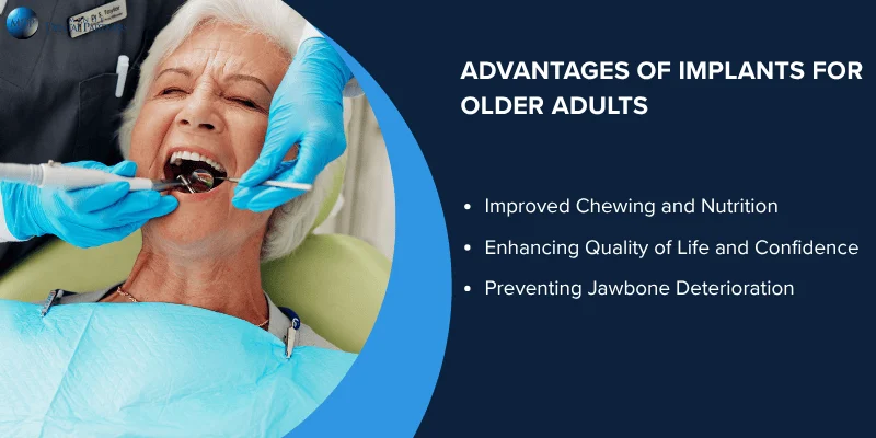 Benefits of Dental Implants for Seniors