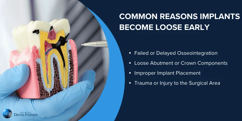Top Causes of Loose Dental Implants in the First 90 Days
