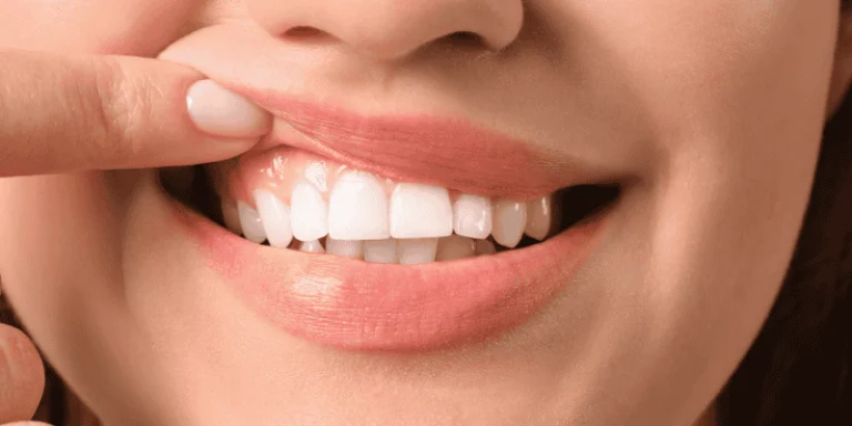 Gum Health Requirements Before Implant