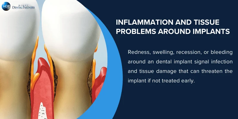 Gum and Tissue Issues Around the Implant