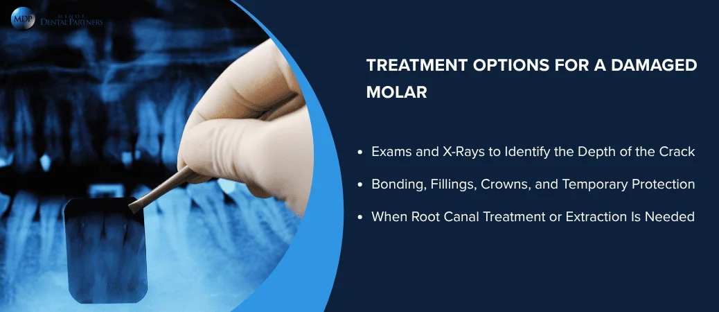 How an Emergency Dentist Can Treat a Damaged Molar