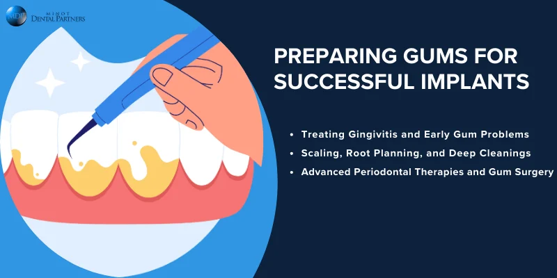 Pre-Treatment Managing Gum Disease for Implant Success