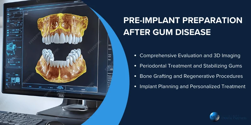 Preparing for Dental Implants After Gum Disease