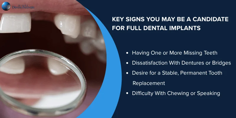 Primary Signs You May Qualify for Full Dental Implants