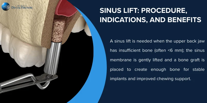 Sinus Lift Procedure, Indications, and Benefits