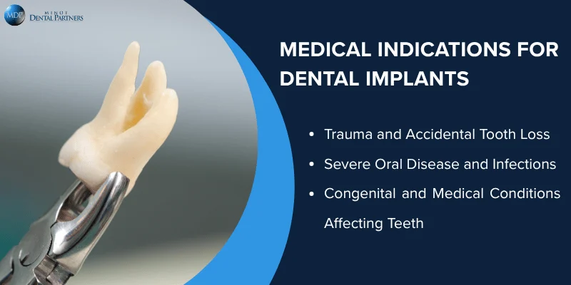 Situations When Dental Implants Are Medically Necessary