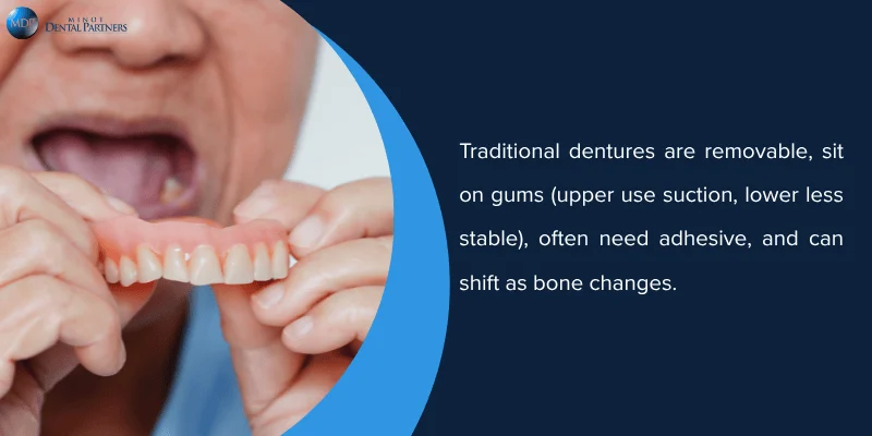 Traditional Dentures Overview