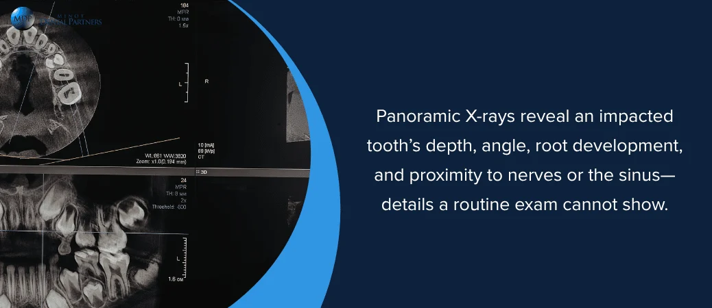 What a Dental Exam and X-Rays Can Reveal