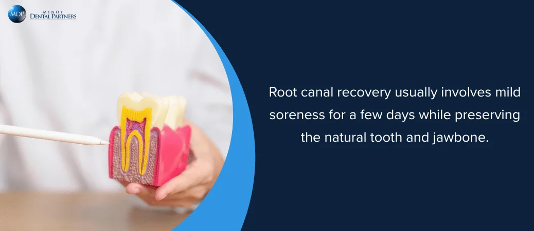 What to Expect During Root Canal Recovery