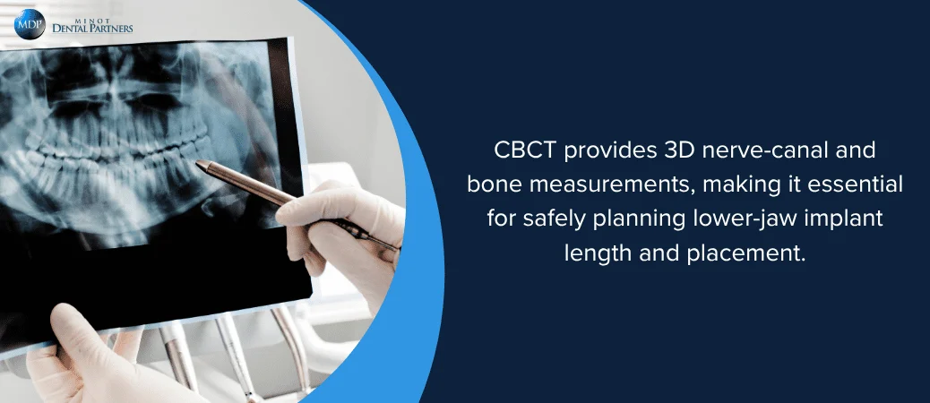 Why Three-Dimensional Imaging Matters Before Implant Surgery
