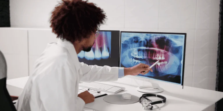 all on 4 vs all on x decision factors