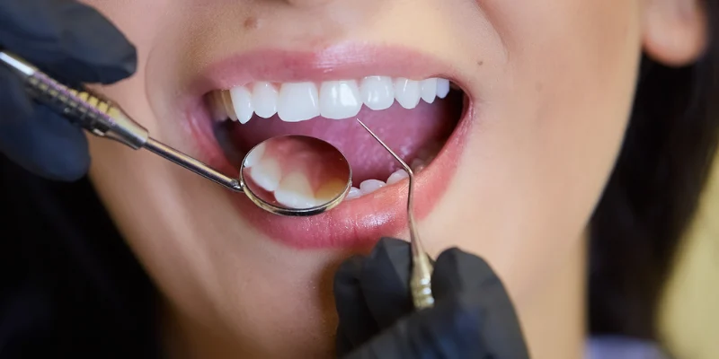 dental implant downtime recovery