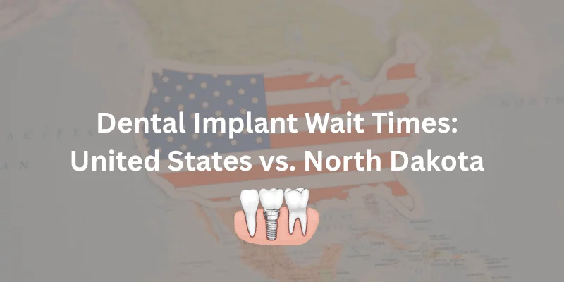 dental implant wait times united states vs north dakota