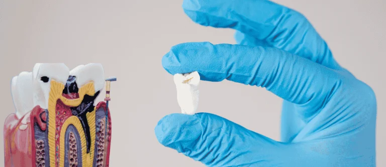 root canal vs tooth extraction