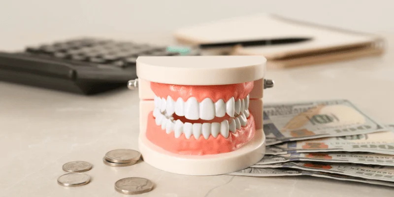 what is included in dental implant cost