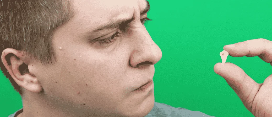 wisdom teeth removal after 30